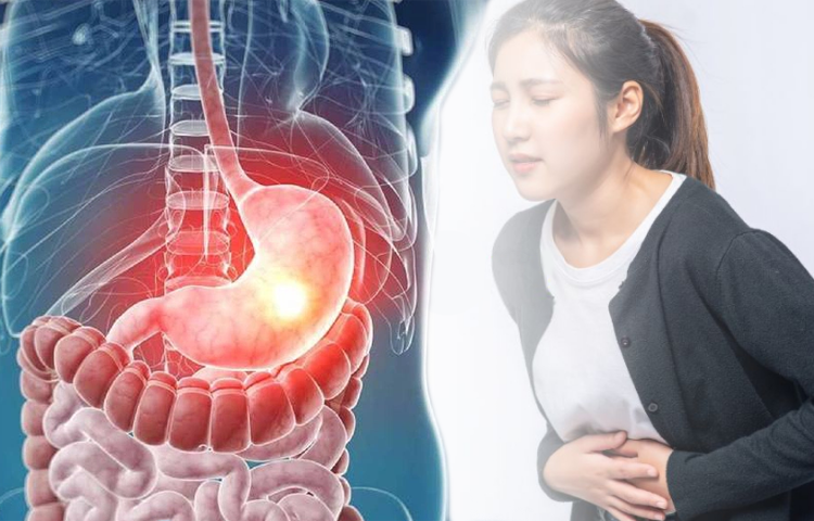 Xoa bóp bấm huyệt điều trị hội chứng dạ dày- tá tràng